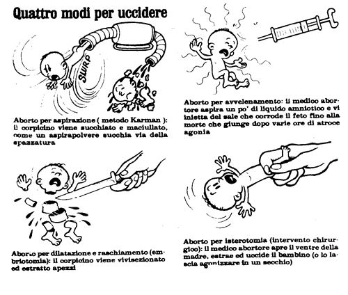 Immagine, aborto: quattro modi per uccidere.