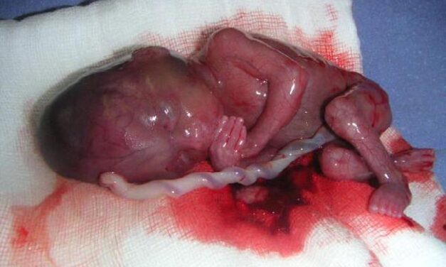 194 (ABORTO): una legge da riformare o abrogare? Sabato convegno a Milano