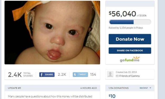 Fanno nascere gemelli da madre surrogata, uno ha la sindrome di Down: abbandonato