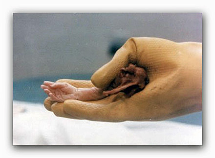 Cortei NO194 a Milano e Caserta il 9 aprile 2016. DDL aborto è reato!