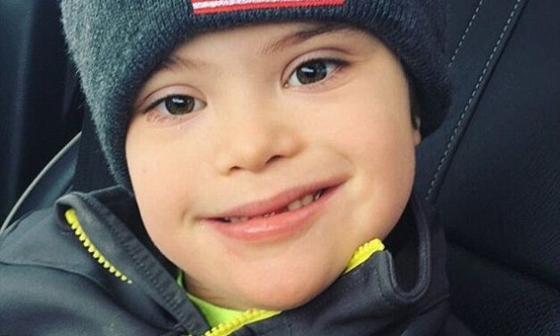 Trump parla nuovamente a favore delle persone con sindrome di Down